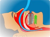 cutaway